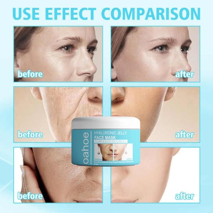 Hyaluronic Jelly Face Mask Acid Anti-Aging Gel Mask (Buy 1 Get 1 Free Offer)