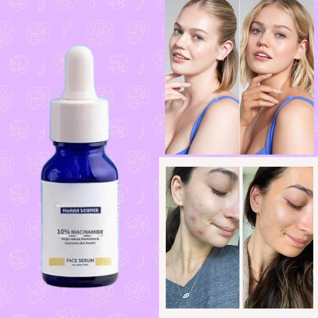 Original 10% Niacinamide Brightening Face Serum 30ml (Buy 1 Get 1 Free Offer)