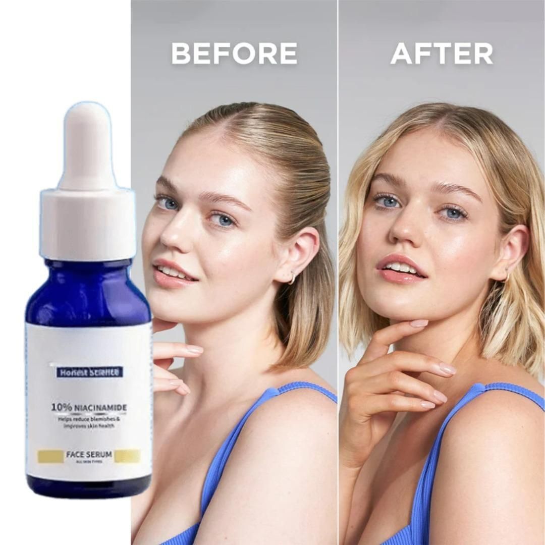 Original 10% Niacinamide Brightening Face Serum 30ml (Buy 1 Get 1 Free Offer)