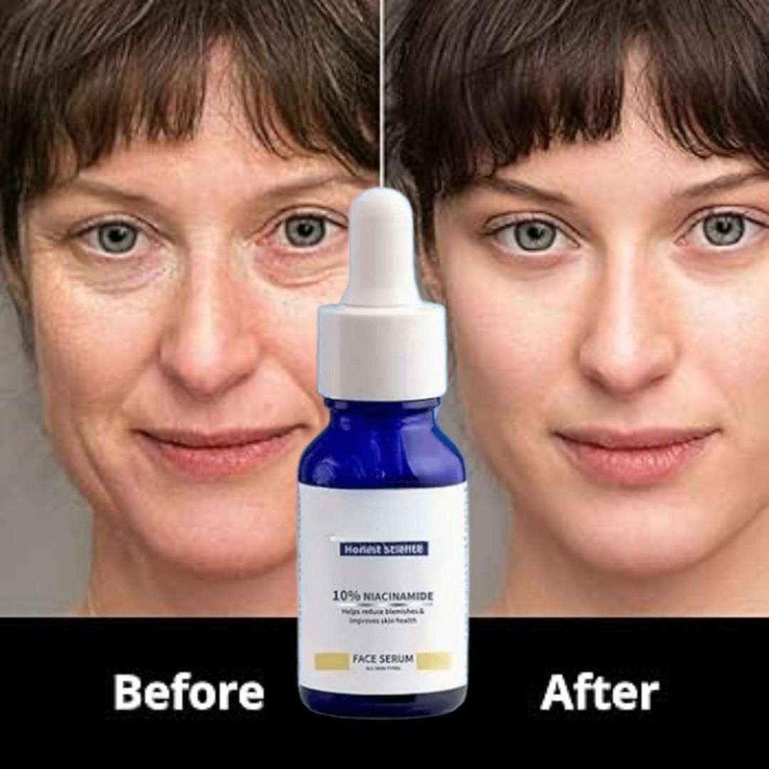 Original 10% Niacinamide Brightening Face Serum 30ml (Buy 1 Get 1 Free Offer)