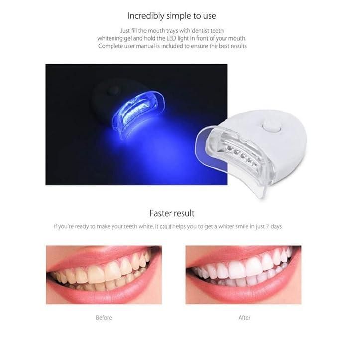 Teeth Whitening Kit - 2nd Gen | Includes 3x Teeth Whitening Pen, Whitening Device, PVC Shade Card, & Mouth Tray | Blue LED Technology & Advanced PAP Formulation | Handsfree & Easy to Use