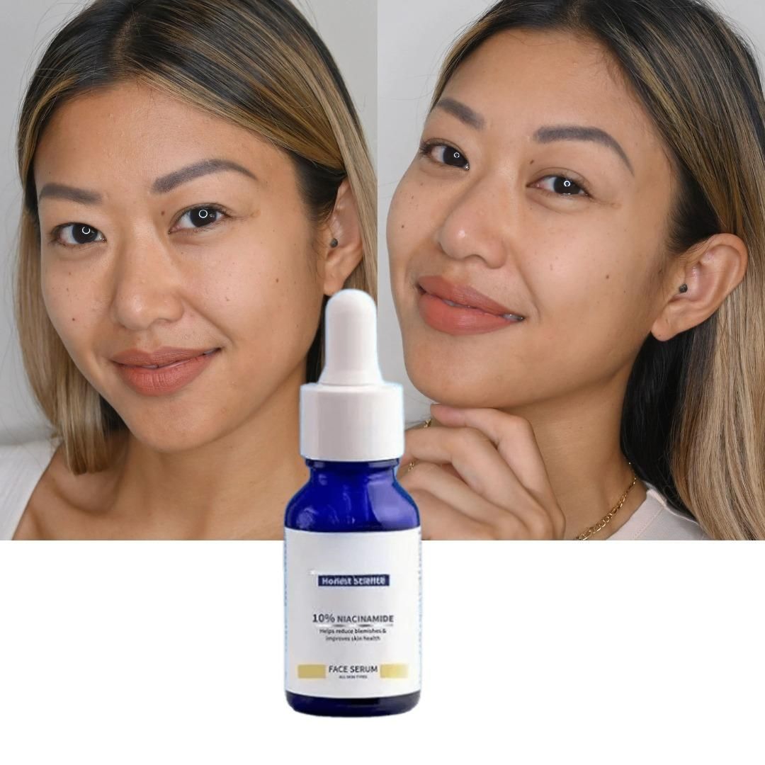 Original 10% Niacinamide Brightening Face Serum 30ml (Buy 1 Get 1 Free Offer)