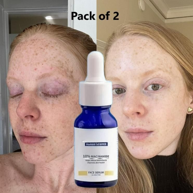 Original 10% Niacinamide Brightening Face Serum 30ml (Buy 1 Get 1 Free Offer)