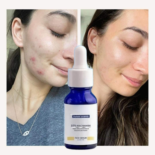 Original 10% Niacinamide Brightening Face Serum 30ml (Buy 1 Get 1 Free Offer)